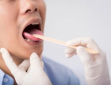 Καρκίνος του στόματος - Σημάδια που δεν πρέπει να παραβλέψετε